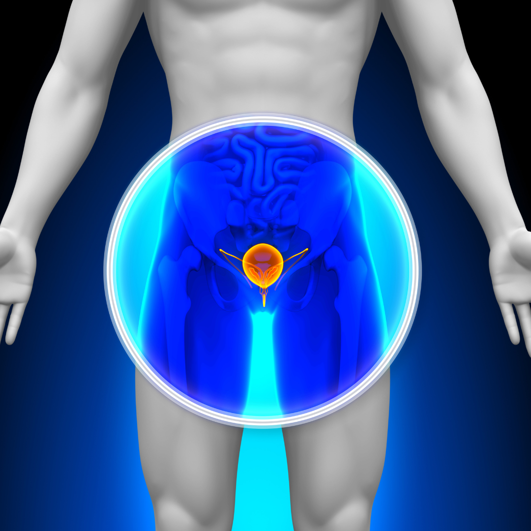 Algorithms for Prediction of Overactive Bladder Response to Third Line Treatment Options 